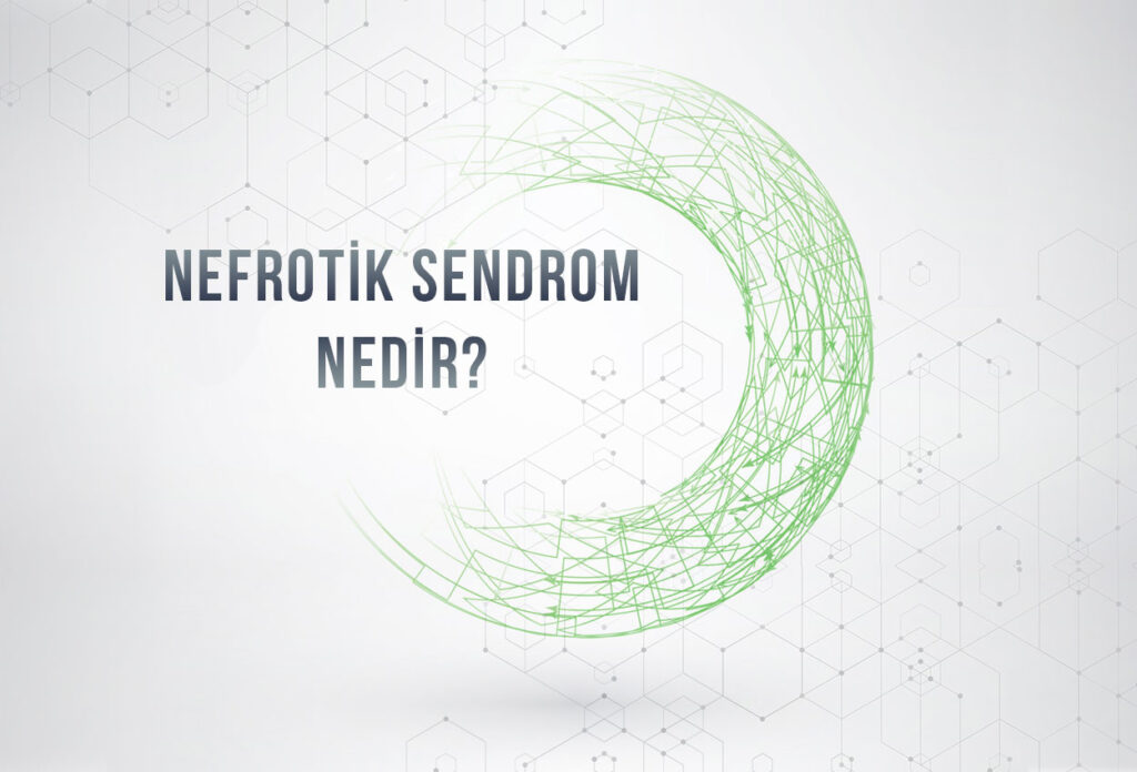 Nefrotik Sendrom Nedir